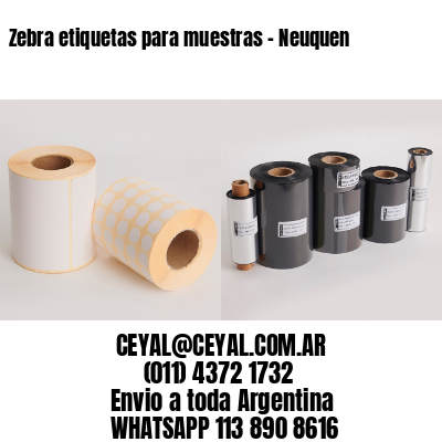 Zebra etiquetas para muestras – Neuquen